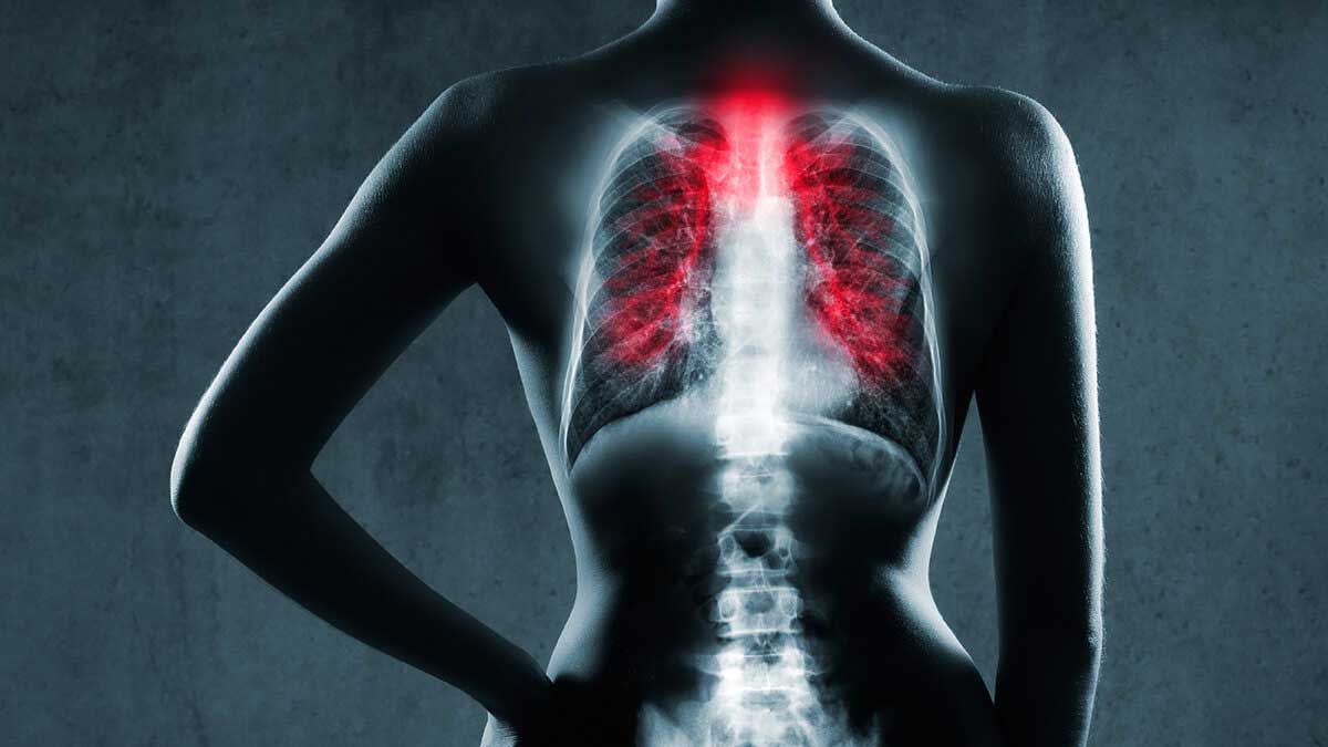 Covid-19 AI diagnostics app for respiratory pathology detection