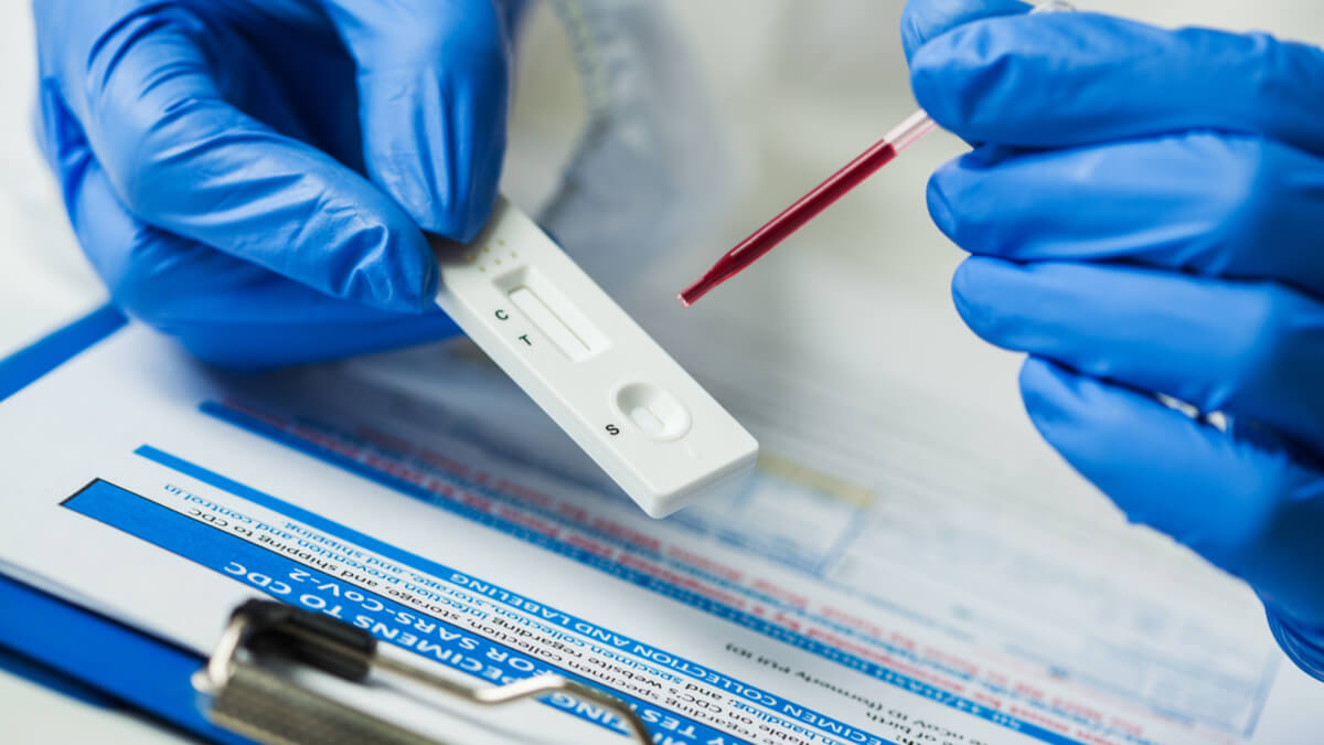 Antibody tests